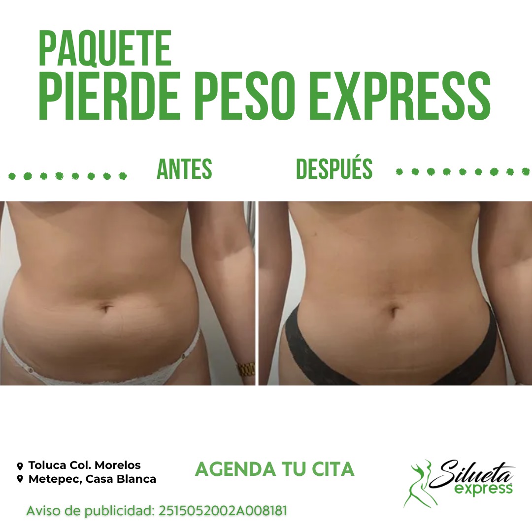 Resultado 2